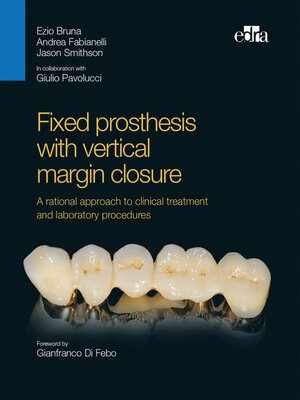 cover image of Fixed prosthesis with vertical margin closure